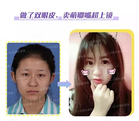 這些眼睛一點都不招人喜歡！