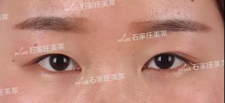 這些眼睛一點都不招人喜歡！