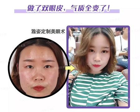 這些眼睛一點都不招人喜歡！