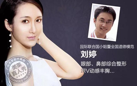  23-24日，韓國(guó)較會(huì)整容的柳元敏博士，來(lái)了！
