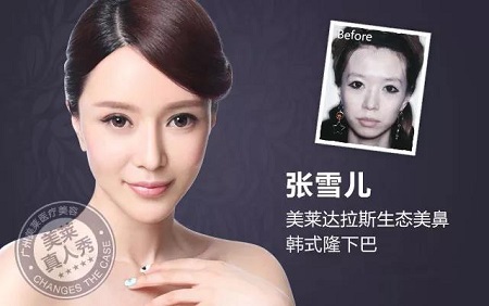  23-24日，韓國(guó)較會(huì)整容的柳元敏博士，來(lái)了！