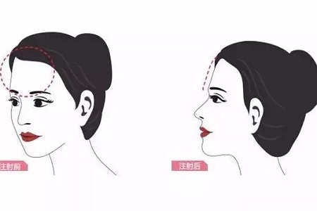 知道么？額頭飽滿的女人好命