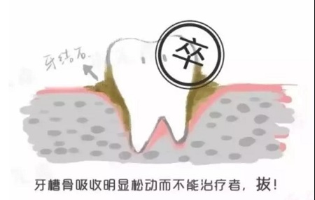 牙齒矯正可以用一輩子嗎？