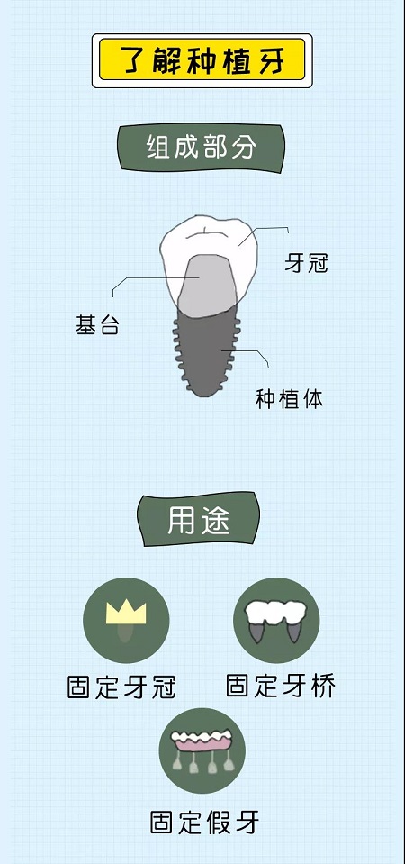 牙齒矯正可以用一輩子嗎？