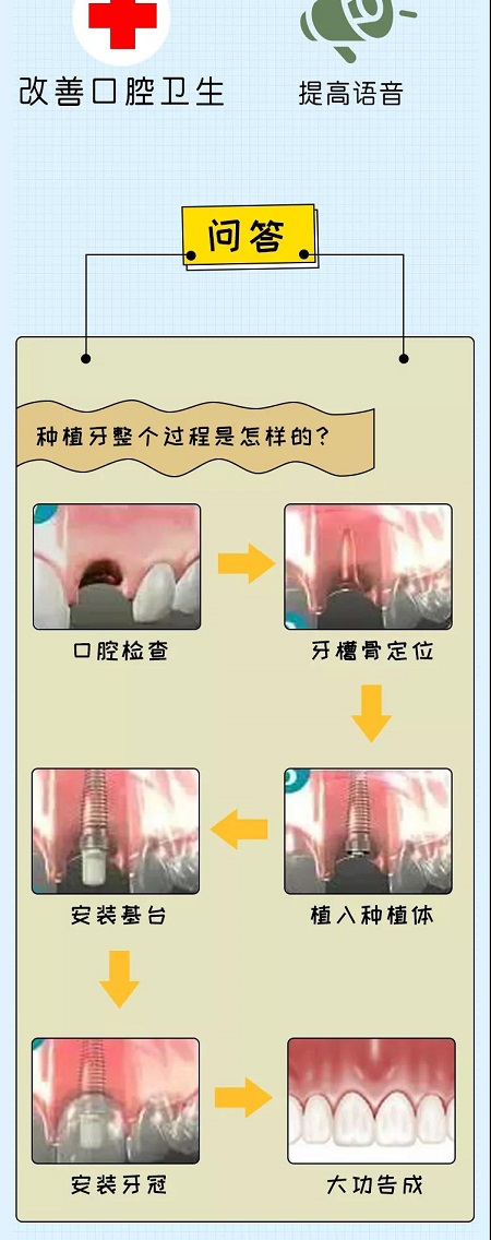 牙齒矯正可以用一輩子嗎？