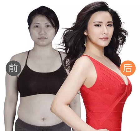 3月27-28日，世界吸脂王志軍來了！