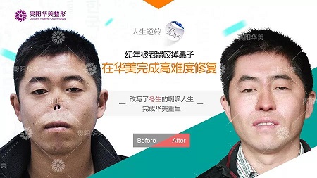 【真人秀】別再問隆鼻難不難做，沒有鼻子都能變出來！