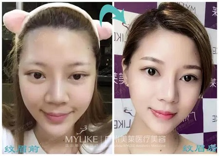 水光、紋眉