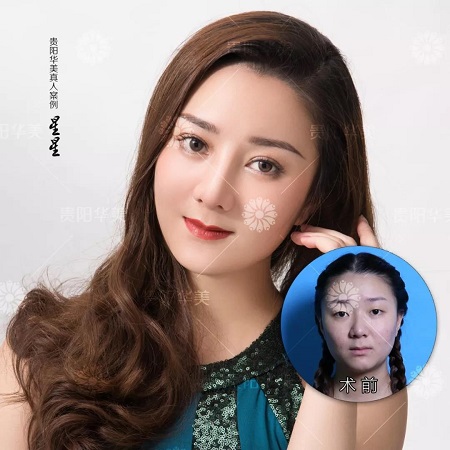 【真人秀】貴陽小熱巴，原來整容以前長這樣~