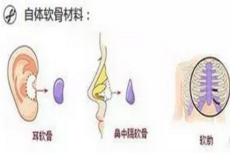 哪些人適合半肋，哪些人適合全肋？