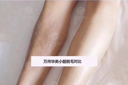 萬人脫毛節(jié)丨脫毛到底要幾次才能脫干凈呢？