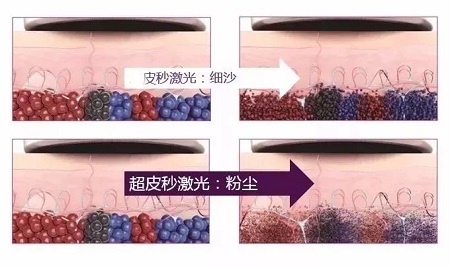 關(guān)于祛斑，可不能用美圖秀秀、輕顏相機(jī)、無他相機(jī)麻痹自己！