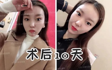 天天喊著要減肥！減肥！但，你真的胖嗎？