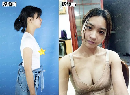 專業(yè)打假！所謂的豐胸秘籍是什么？！