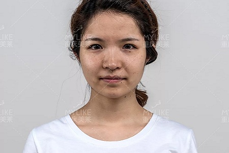 抗初老警報！萬物皆上漲、唯有臉下垂，你還說你不是老阿姨