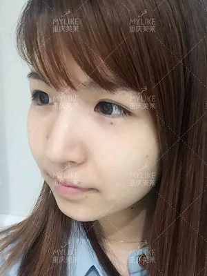 抗初老警報！萬物皆上漲、唯有臉下垂，你還說你不是老阿姨