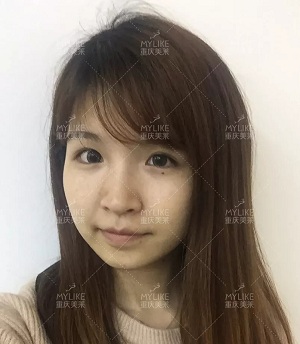 抗初老警報！萬物皆上漲、唯有臉下垂，你還說你不是老阿姨