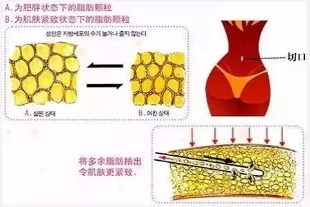 四月不吸脂，五、六、七月徒傷悲......