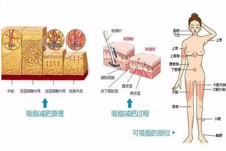 四月不吸脂，五、六、七月徒傷悲......
