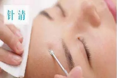 擠痘竟然被送進(jìn)ICU！你的痘痘還好嗎？
