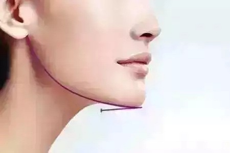 從“側(cè)顏癱”到“側(cè)顏殺”，其實(shí)只需要一點(diǎn)小改變