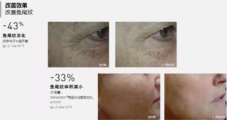 抗衰老的“水光”究竟為何飽受稱贊？