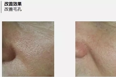 抗衰老的“水光”究竟為何飽受稱贊？