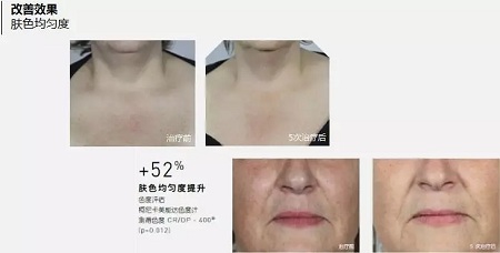 抗衰老的“水光”究竟為何飽受稱贊？