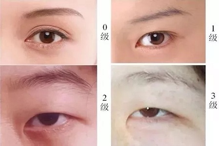 推薦這幾種增大眼睛的方法，除了開(kāi)外眼角！