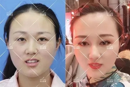 推薦這幾種增大眼睛的方法，除了開(kāi)外眼角！
