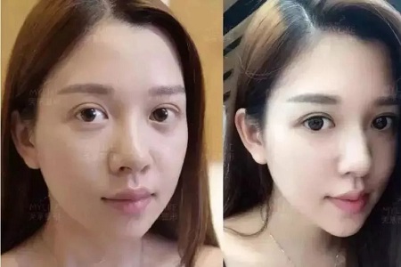 推薦這幾種增大眼睛的方法，除了開(kāi)外眼角！