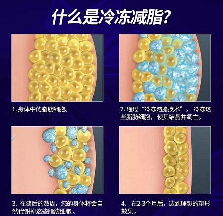 瘦身Flag挑戰(zhàn)賽 | “躺著就能瘦”真的不是夢(mèng)，人人都可以！