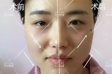 沒有誰能永遠(yuǎn)年輕，不老都是保養(yǎng)的早！