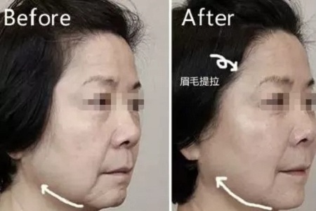 沒有誰能永遠(yuǎn)年輕，不老都是保養(yǎng)的早！