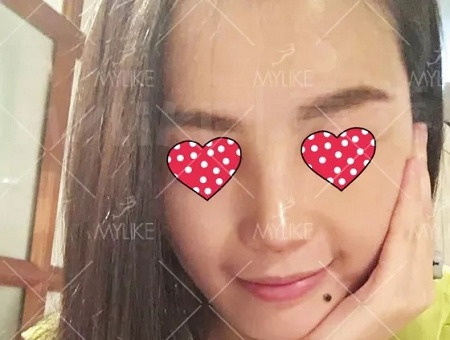 顏值：隆了個(gè)鼻子，男朋友說(shuō)像換了一個(gè)女朋友