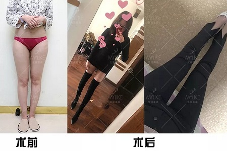顏值：金剛?cè)绾位黹L(zhǎng)腿女神？