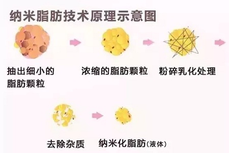 拿什么拯救你，我的黑眼圈？