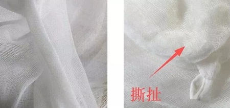 為什么瘦人也會(huì)有“肥胖紋”？