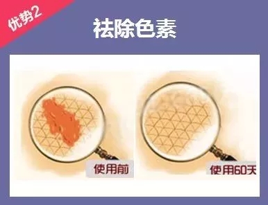 為什么瘦人也會(huì)有“肥胖紋”？
