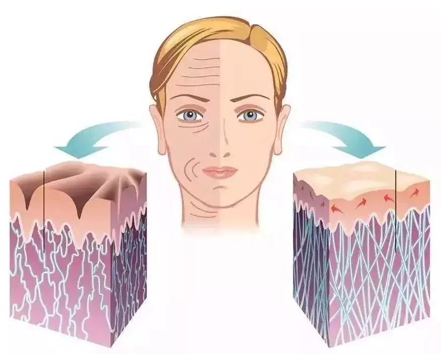 你討厭的脂肪，用在臉上就是寶貝！
