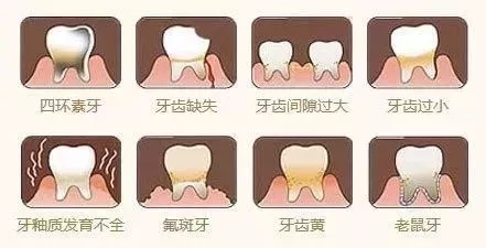 問(wèn)診室：為什么我的牙卻永遠(yuǎn)也刷不白？