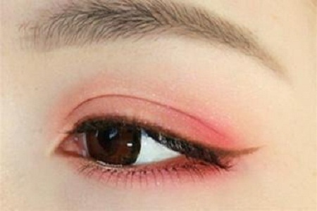 雙眼皮+開眼角為什么是較佳拍檔，一分鐘帶你看懂！