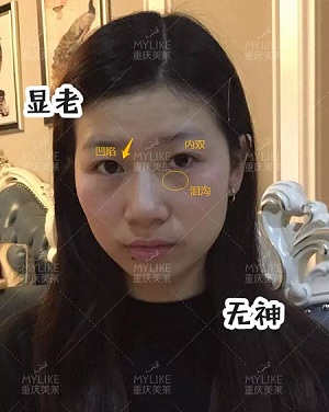 市面上五花八門的雙眼皮項目，如何有效找到你的菜？