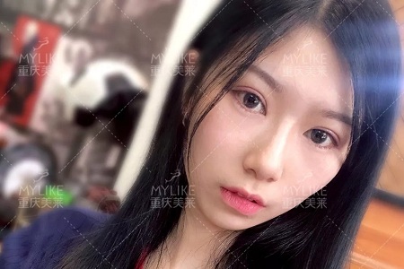 市面上五花八門的雙眼皮項目，如何有效找到你的菜？