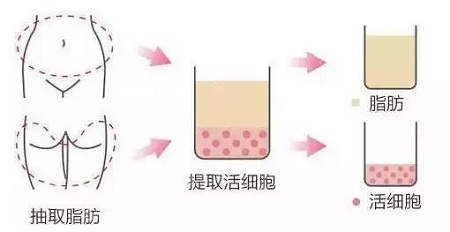 美萊實驗室：當(dāng)顏值遇上“胸”霸，男人一般都會怎么選？