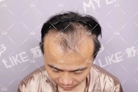 好看的皮囊千千萬(wàn)，但都有一個(gè)共同點(diǎn)-頭發(fā)！