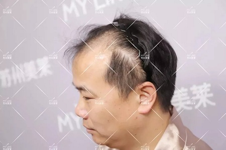 好看的皮囊千千萬(wàn)，但都有一個(gè)共同點(diǎn)-頭發(fā)！