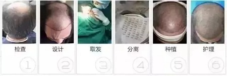 好看的皮囊千千萬(wàn)，但都有一個(gè)共同點(diǎn)-頭發(fā)！