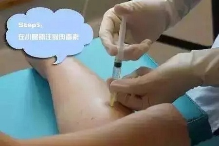 這有一個快速又持久瘦小腿的方法！請注意查收！