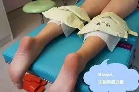 這有一個快速又持久瘦小腿的方法！請注意查收！